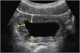 The Radiology Assistant Normal Values In Ultrasound