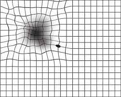 The grid was developed by marc amsler, a swiss ophthalmologist. Have Amd Save Your Sight With An Amsler Grid American Academy Of Ophthalmology