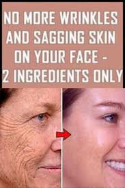 Elsa Dennis (elsad1313)