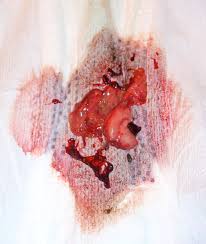This misplaced tissue changes throughout the menstrual. Uterine Lining Slimpickins S Weblog