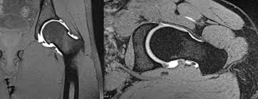 Die großen röhren erzeugen faszinierende bilder. Kernspintomographie Xcare Radiologie Nuklearmedizin Strahlentherapie Im Saarland Und Der Region Trier