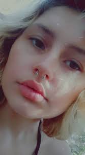 How long does it take for a septum to heal?