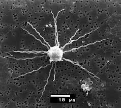 Image result for Microcoelia physophora