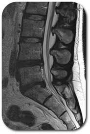 Mit der ganzkörper mrt ist es möglich den gesamten körper ohne strahlenbelastung auf einmal zu untersuchen. Mrt Ihre Radiologen Im Havelland