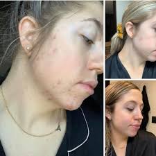 Martha Manso (@martha_manso) • Instagram photos and videos