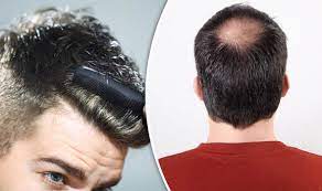 As new hair is manufactured in the follicle, it pushes out the hair shaft, creating longer hair. Baldness Cure Scientists Discover New Way Of Triggering Hair Growth Express Co Uk