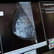 Mammografie Screening Die Wichtigsten Fragen Und Antworten Gesundheit