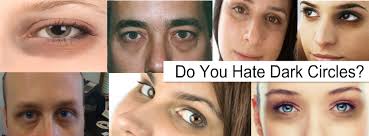 Now let's go over how to deal with dark. I Hate Dark Circles Under Eyes Home Facebook