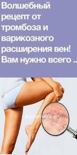 чем лечить варикозное расширение вен на ногах в домашних условиях Volshebnyj Recept Ot Tromboza I Varikoznogo Rasshireniya Ven Vam Nuzhno Vsego 2 Prostyh Ingredienta Health Fitness Health Healthy Eating