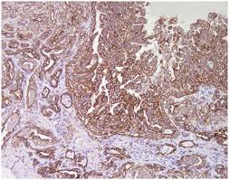 Similarly, the best evidence of histological diagnosis, . Frontiers From Conventional To Precision Therapy In Canine Mammary Cancer A Comprehensive Review Veterinary Science
