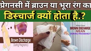 Towards the end of pregnancy, the amount of discharge increases further. à¤ª à¤° à¤—à¤¨à¤¸ à¤® à¤¬ à¤° à¤‰à¤¨ à¤¡ à¤¸ à¤š à¤° à¤œ Brown Spotting During Pregnancy Brown Discharge During Pregnancy Youtube