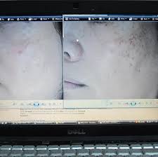 Kandasamy, a dermatologist (skin specialist) since 1985, has been based in the temple town of kanchipuram for the past 33 years. Dr Ting Ee Skin Medical Clinic In Sibu City Malaysia Read 3 Reviews