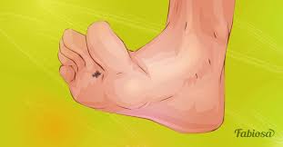 Symptoms tend to start farthest away from the head, but move closer over time. Foot Melanoma Signs Symptoms Treatment And How To Reduce The Risk Of Getting It