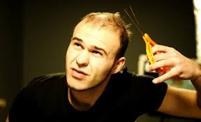 It's important to emphasize that patients who have localized hair loss generally don't go on to lose hair all over the scalp. Role Of Body Hair Transplant In Diffused Alopecia