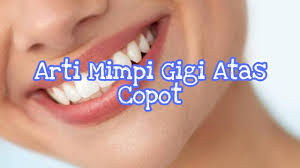 Nah ternyata di balik mimpi ada makna yang lumayan berat jika admin ceritakan. Arti Mimpi Gigi Atas Copot Menurut Islam Primbon Dan Psikologi Youtube