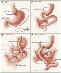 Gastric Prolapse An Overview Sciencedirect Topics