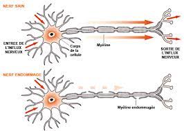 It can cause muscle weakness, reflex loss, and numbness or tingling in parts of your body. Https Www Orpha Net Data Patho Pub Fr Guillainbarre Frfrpub834 Pdf
