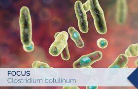 The botulinum toxin can cause botulism; Clostridium Botulinum An Increasing Food Safety Issue Food Compliance Solutions