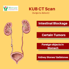 Kub Ct Scan Helps To Detect In 2020 Ct Scan Helpful Facebook Sign Up