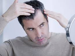 If i had short hair and the same amount fell out, you wouldn't even be able to see it. Hair Products For Men With Thinning Hair