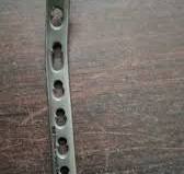 Titanium Distal Humerus Locking Plate
