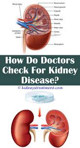 Kidney Disease Awareness Etsy Kidney Disease Recipes Kidney Disease Diet Kidney Disease Symptoms