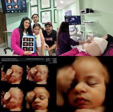 Ayer realizamos el ultrasonido a la ganadora del sorteo. Dana Camacho La  verdad nos encantó la respuesta y la participación de todos. Esperamos  hacer nuevas dinámicas y poder darles un cachito de