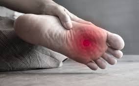 Ball of foot pain — metatarsalgia treatment by podiatrist in Centurion