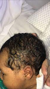 Biracial Baby Hair April 2018 Babies Forums What To Expect