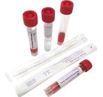 Oropharyngeal Adhesive Swab Flocked Viscose Swab-Test Sample ...