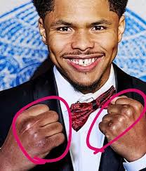 Shakur's knuckles tell a story of battle, sacrifice and war. 3 Division  World Champ 👑