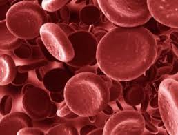 • fatigue • susceptibility to infection • delayed growth and. Anemia Causes Symptoms And Treatment Live Science