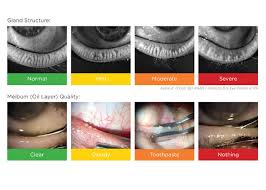 Image result for Blepharis bainesii