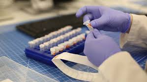 Der pcr test gilt als goldstandard zum der abstrich wird mittels rachenabstrich gewonnen. Pcr Tests Am Frankfurter Flughafen Centogene Und Lufthansa Ziehen Zum Ende Der Sommerferien Positive Bilanz Lufthansa Group