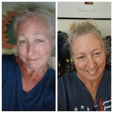 6 months post gastric sleeve surgery progress update