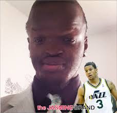EXCLUSIVE] NBA Baller Trey Burke: I Had No Idea Man in Selfie Had Medical  Disorder