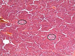 Check spelling or type a new query. Pancreas