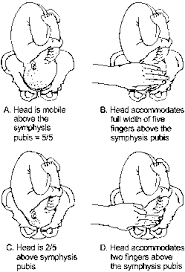 Pregnancy Stations Of Engagement Related Keywords