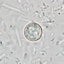 Image result for Cyclospora