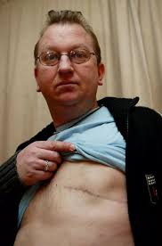 Dad-of-two devastated after being diagnosed with breast cancer for THIRD  time despite removal procedure a decade ago