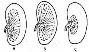 Check spelling or type a new query. The Diagrams Show Vertical Sections Of Kidneys Of Coypu Brown Rat And Kangaroo Rat Showing The Relative Size Of Cortex And Medulla Coypu Is Found In Freshwater And Is Never Of Short