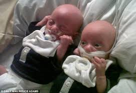 What age to take away pacifier? Mother S Horror After Discovering Dummy Taped To Her Four Month Old Baby Boy S Mouth At Scandal Hit Nhs Trust Daily Mail Online