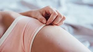 Untreated Yeast Infection: Why It ...