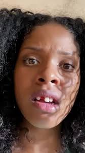 #Starling part 2 🦷😰✨ #hookedtv #fyp #boo #horrotok