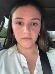 Meet Shelly, a nurse injector at one of Kentucky's top med spas. She's had  injectables. She gives injectables. She has access to it all. And even she  has to be shocked by