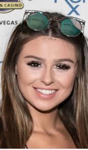 Raquel's Hair Line? : r/Vanderpumpaholics