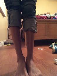 About 784 results (0.1 seconds). I Have Really Skinny Legs Ankles And I Hate It Is There Anything Possible I Can Do Please Photos