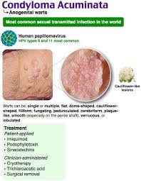 Condyloma Acuminata Rosh Review Cancer Facts Medical Mnemonics Nummular Eczema