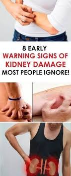 When The Function Of Some Of Our Body Organs Is Somehow Affected You Are Definitely Going To Experience Some Sympt Kidney Damage Kidney Stones Symptoms Health