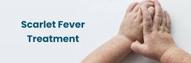 Image result for Scarlet Fever